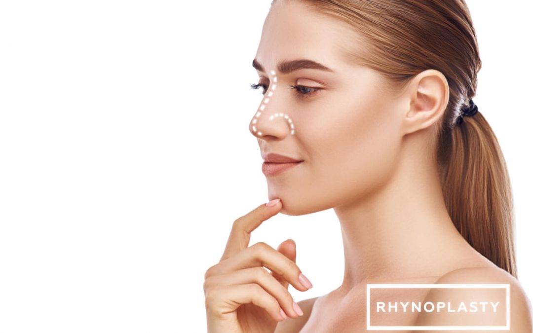 The Rhinoplasty Swelling Timeline: How Long Does It Last?
