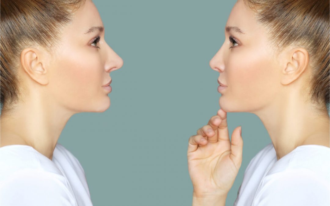 What Are The Results of A Nose Job Before And After?